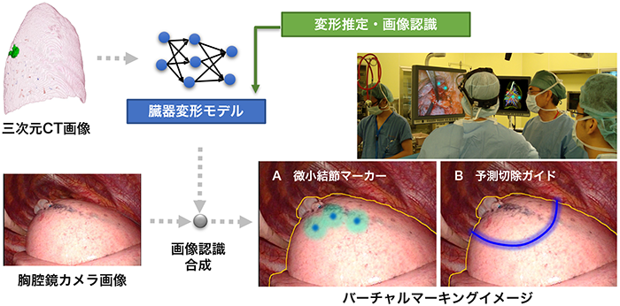治療時に撮像可能な低次元画像に基づく腫瘍位置同定